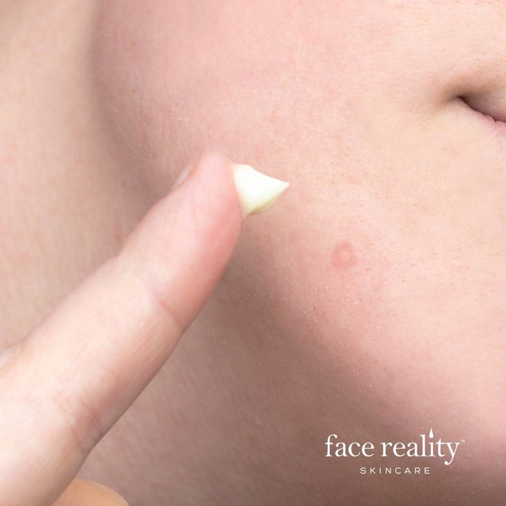 Face Reality Sulfur Spot Treatment (PRE-ORDER)