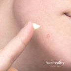 Face Reality Sulfur Spot Treatment (PRE-ORDER)